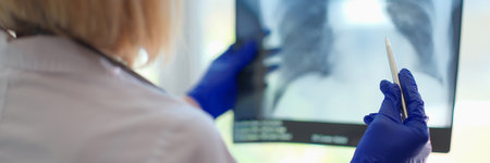Female doctor pulmonologist holding x-ray photograph of lungs in handsの写真素材
