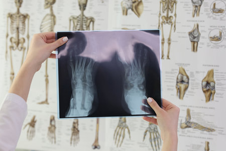 Doctor holds X-ray picture of patient feet in hospitalの写真素材
