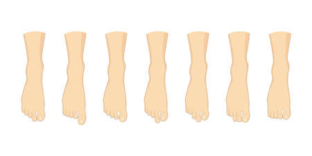Foot toe shape types set. Human feet vector illustration. Body forefoot anatomyのイラスト素材