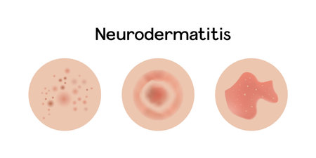 Neurodermatitis examples vector illustration design, allergic problemsのイラスト素材