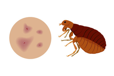 Flea causing skin irritation and itching sensationのイラスト素材