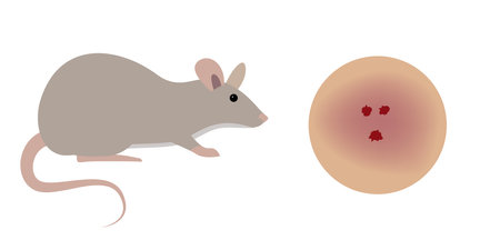 Rat Biting Human Skin Causing Bleeding Wound and Infectionのイラスト素材