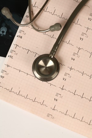 Doctor's stethoscope and chart a patient's heartの写真素材