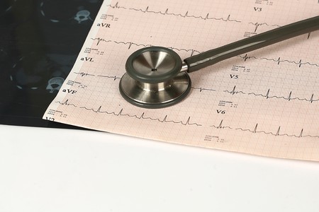 Doctor's stethoscope and chart a patient's heart