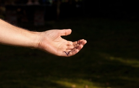 little finger stitched after an operationの写真素材