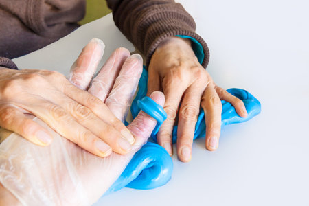 hand physiotherapy to recover a broken finderの写真素材