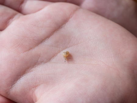 Grove snail (Cepaea nemoralis) is a species of air-breathing land snail, a terrestrial pulmonate...