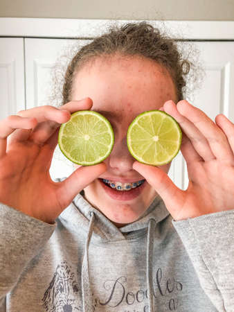 Girl with two half cut limes.の写真素材