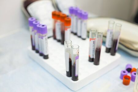 laboratory test tubes fullfilled with different blood samplesの写真素材