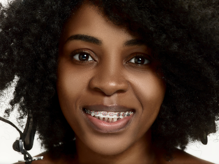 Portrait of a young black african american woman smiling with bracesの写真素材
