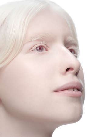 Dreams. Portrait of beautiful albino woman isolated on white studio background. Beauty, fashion, skincare, cosmetics concept. Copyspace. Well-kept skin, fresh look. Inclusion and diversity.の写真素材
