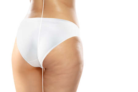 Overweight woman with cellulite legs and buttocks in white underwear comparing with fit and thin body isolated on white background. Orange peel skin, liposuction, healthcare, beauty, sport, surgery.の写真素材