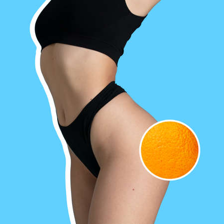 Young woman with orange on blue background. Cellulite and problem skin concept.の写真素材