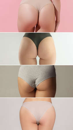 Girls buttocks isolated over pink, white and gray back ground. Fitness, diet, sports, plastic surgery and aesthetic cosmetology concept. Back view. Composite image, collageの写真素材