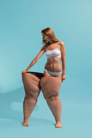 Collage with beautiful thin girl with plus-size body with cellulite skin isolated on blue background. Weight loss, fitness, healthy eating, motivation concept.の写真素材