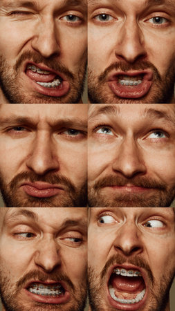 Collage of bearded young man with braces, featuring range of humorous and exaggerated facial expressions. Playful and quirky emotionsの写真素材