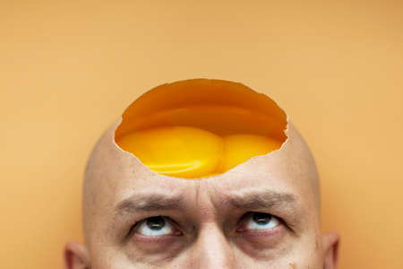 The concept of a lack of thoughts in the head, no ideas. On a bald head, a man has an open, raw,...