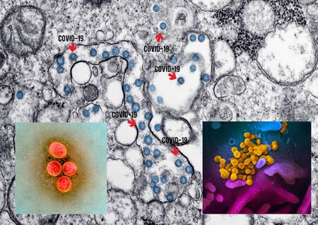 Coronavirus microscope photo