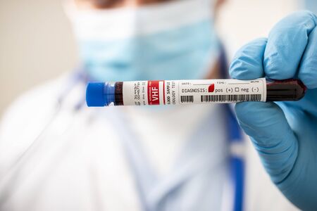 View of a doctor holding a fictional test tube blood sample, infected with VHF virus.