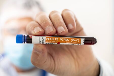 View of a doctor holding a fictional test tube blood sample, infected with Measles virus.