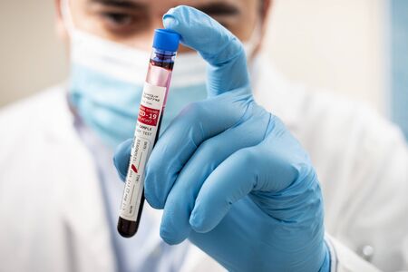 View of a doctor holding a fictional test tube blood sample, infected with coronavirus.
