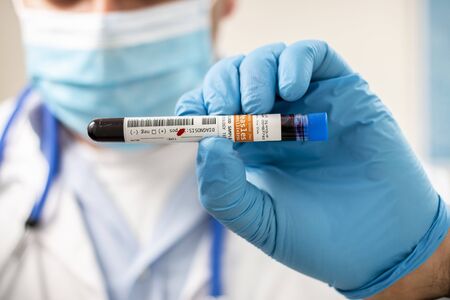 View of a doctor holding a fictional test tube blood sample, infected with measles virus.の写真素材