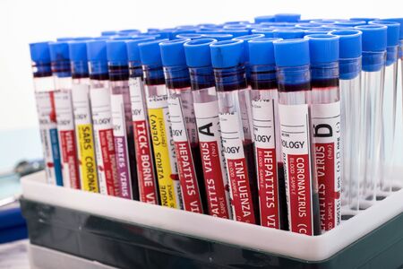 Several fictional infected blood samples with various virus on a vial rack.