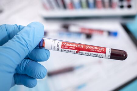 Fictional Blood samples with infected coronavirus (covid-19), with stethoscope, mask and syringe and other stuff.の写真素材