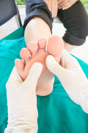 diabetic foot skining  neuropathyの写真素材