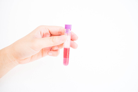 hand of a lab technician holding blood tube test fasting blood sugar isolated white backgroundの写真素材