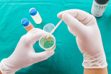 Reagent Strip for Urinalysis , Routine Urinalysisの写真素材