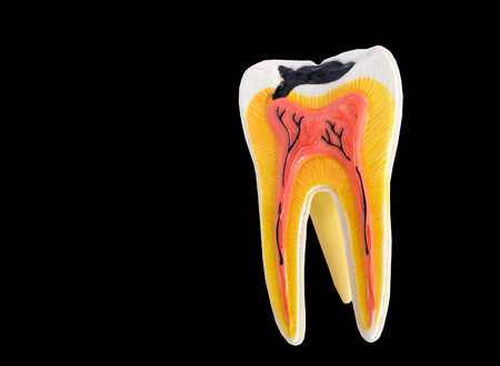 Tooth anatomy model