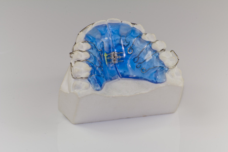 Braces