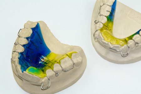 removable bracesの写真素材