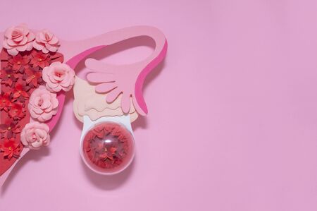 Creative paper concept of endometrioid ovarian cyst.の写真素材