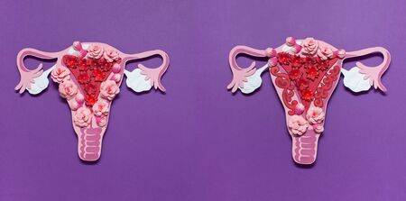 The womens reproductive system. The concept of endometriosis of the uterus.の写真素材