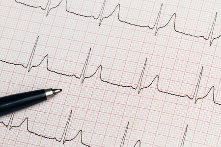 Part of an electrocardiogram printed in paperの写真素材