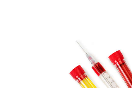 Test tubes and a syringe with urine and blood on a white background with copy space