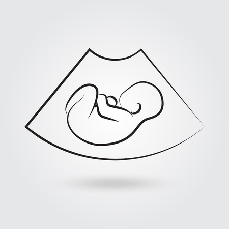 Ultrasonic picture of unborn baby. Vector illustrationのイラスト素材