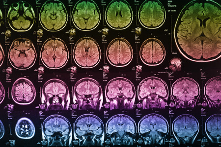 The X-ray of the human brain closeup image