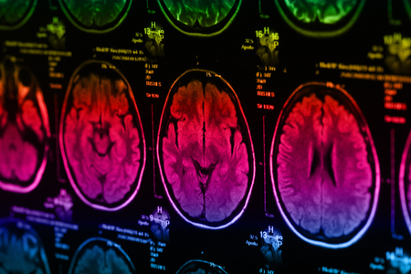 The X-ray of the human brain closeup imageの写真素材