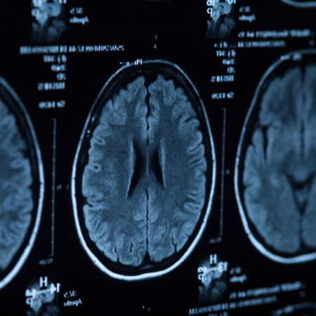 The X-ray of the human brain closeup image