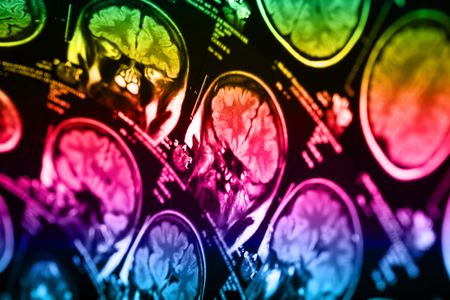 The X-ray of the human brain closeup imageの写真素材