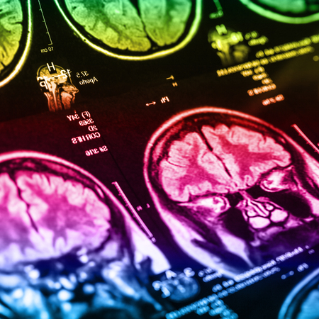 The X-ray of the human brain closeup imageの写真素材