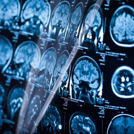 The X-ray of the human brain closeup imageの写真素材