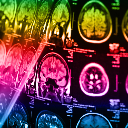 The X-ray of the human brain closeup image