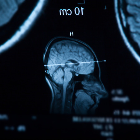 The X-ray of the human brain closeup imageの写真素材