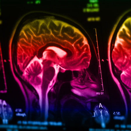 The X-ray of the human brain closeup imageの写真素材