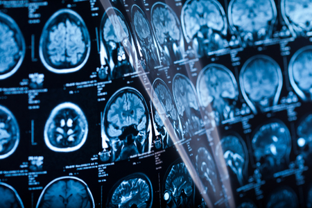 The X-ray of the human brain closeup imageの写真素材