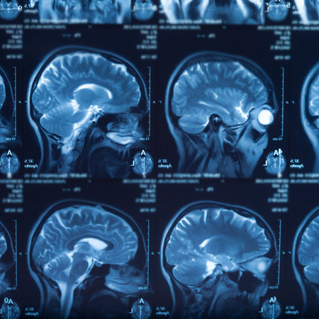 The X-ray of the human brain closeup imageの写真素材